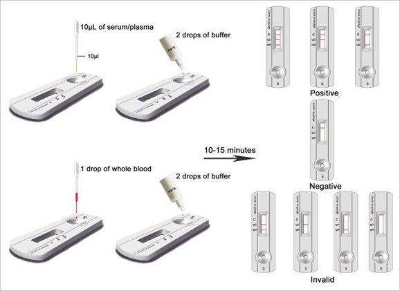 Coronavirus Test Kit and Device Reading